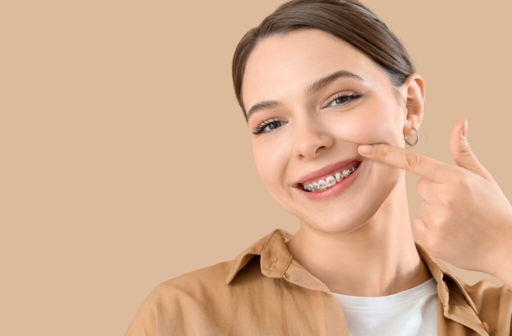 Girl smiling with and pointing to traditional metal braces on her teeth.