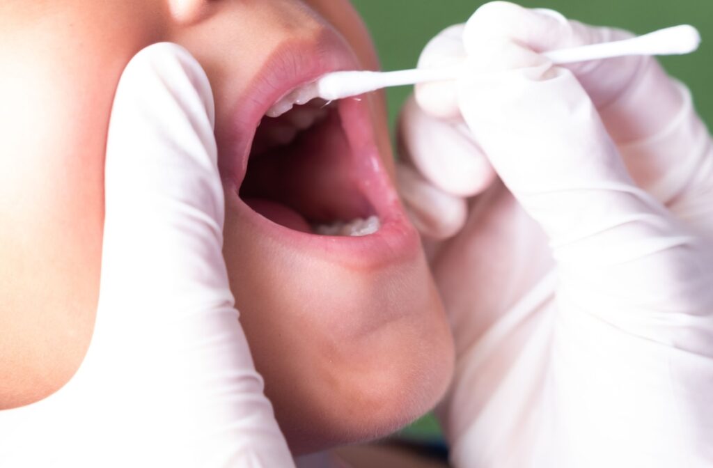 A dentist applies fluoride varnish to child's teeth to prevent tooth decay.