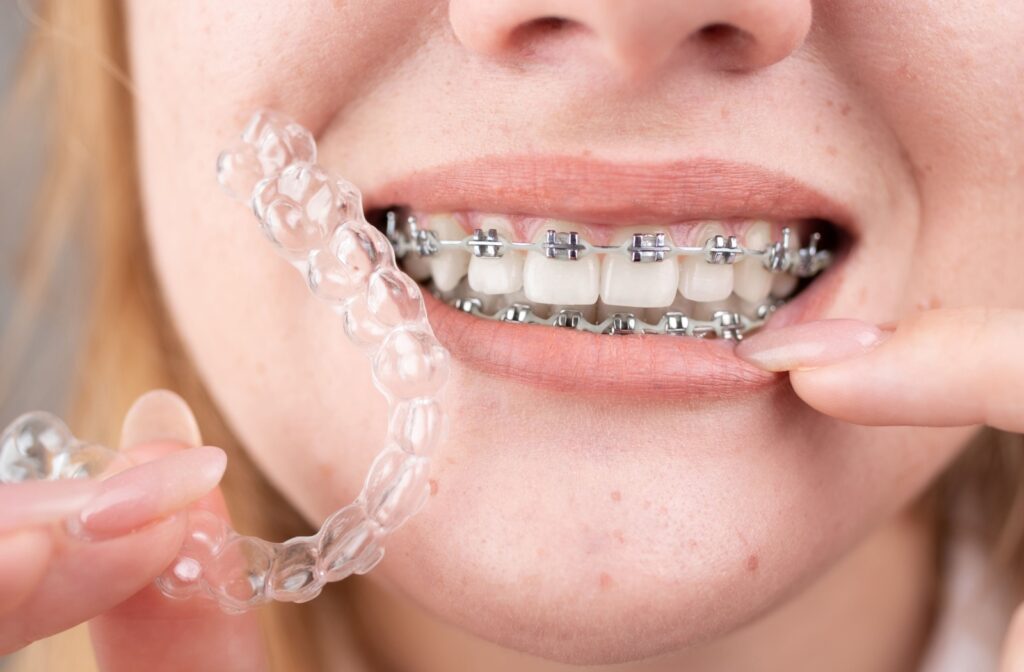 A close up of a smile with braces, while a hand holds an Invisalign clear aligner beside.
